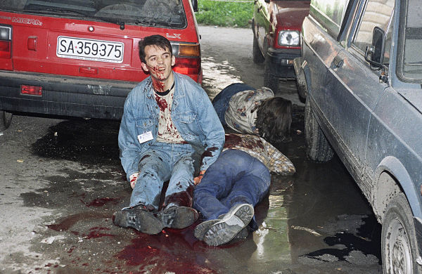 A wounded Sarajevo resident sits in shock next to two other seriously wounded civilians moments after one of several mortar shells landed in central Sarajevo on June 22, 1992.